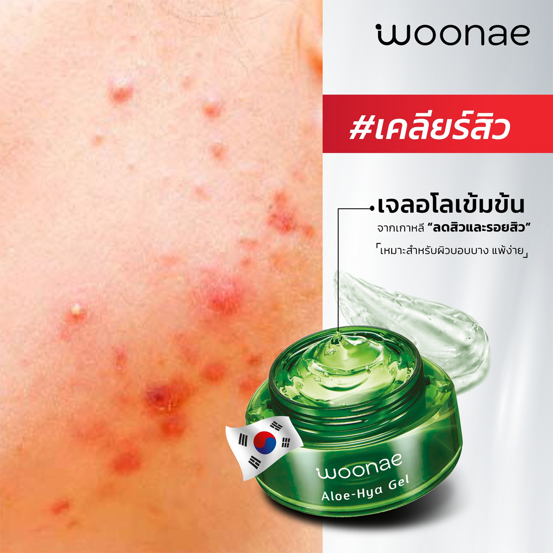 WOONAE_ALOE_SOOTHING_GEL-JPG3